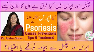 Psoriasis Explained  Symptoms Prevention Treatment amp Myths  Tips for Healthy Skin draishaghias [upl. by Llerahc]