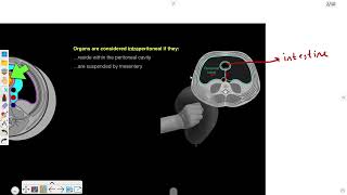 GIT  peritoneum  1 Anatomy of Peritoneum [upl. by Nnaylloh]