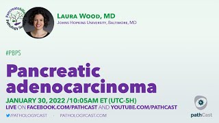 Pancreatic ductal adenocarcinoma and variants  Dr Wood [upl. by Hurst987]