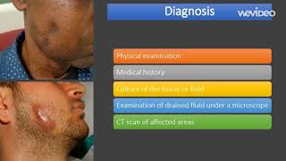 actinomycosis  causes diagnosis treatment comp [upl. by Johanna330]