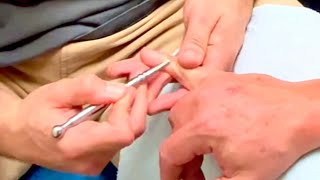 Hand and finger deep massage using acupressure pen Josh massaging Brandon part 5 [upl. by Ciryl627]