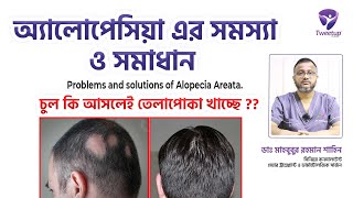 অ্যালোপেসিয়া এর সমস্যা ও সমাধান । । Problems and solutions of Alopecia Areata [upl. by Glori598]