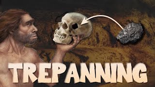 The History of Trepanning [upl. by Haseena524]