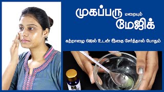 How To Remove Pimples with Aloe Vera Gel Skincare Tamil Beauty Tips [upl. by Sachi652]