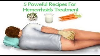 5 Powerful Recipes For Hemorrhoid Treatment [upl. by Elvah]