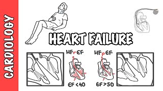 Heart failure with reduced and preserved ejection fraction pathophysiology and treatment [upl. by Mencher141]