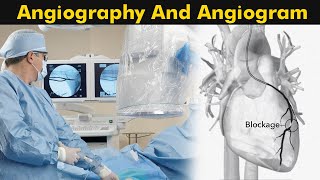 What is Angiography and Angiogram  How Angiography is performed 3D Animation [upl. by Notsur]