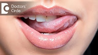 What causes white tongue amp can kissing or alcohol lead to Oral Candiasis  Dr Sangeeta Honnur [upl. by Yentruocal]