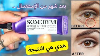 تجربتي مع some by mi retinol eye cream  كريم العين للتجاعيد  retinol [upl. by Aislehc405]