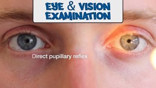 Examination of the Eyes and Vision  OSCE Guide old version  UKMLA  CPSA [upl. by Rancell408]