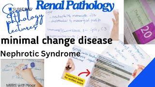 minimal change disease  nephrotic syndrome  renal pathology lectures  selflessmedicose [upl. by Dumanian974]