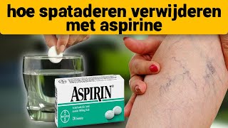 Spataderen verdwenen op de 7e dag neem aspirine en [upl. by Nichol]