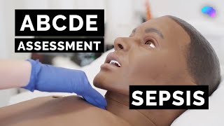 ABCDE Assessment  Sepsis  Emergency Simulation Scenario  OSCE Guide  UKMLA  CPSA [upl. by Adams]