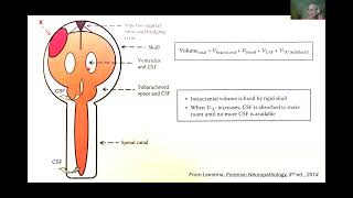 AANP Teaching Rounds  September 23 2024  Neuropathology of Brain Swelling and Herniation [upl. by Luis]