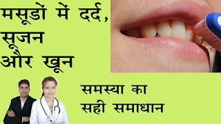 मसूडों में दर्दसूजन और खून आने की समस्या का सही समाधान।Masudo Me Dard Ka Ilaj in Hindi Gingivitis [upl. by Guenzi]