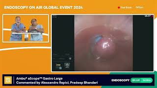 1  Ambu® aScope™ Gastro Largemp4 [upl. by Ttocserp]