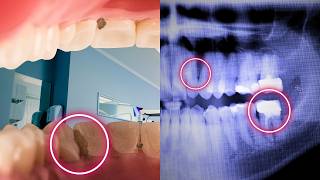 I answered your questions about Dental Xrays  Dentist in Nairobi Kenya [upl. by Atalante]