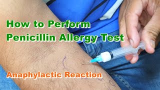 Penicillin G Allergy Test  Benzylpenicillin  Type 1 Hypersensitivity Reaction  How to Do [upl. by Soluk]