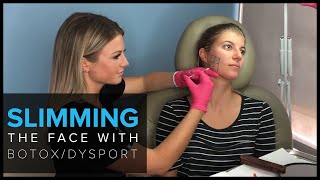 Slimming the Face with BOTOX and Dysport in San Francisco [upl. by Yllah903]