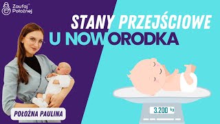 Stany przejściowe u noworodka Opowiada położna Paulina z Zaufaj Położnej [upl. by Hafital]