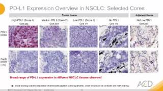 Surveying Expression of Immune Checkpoint Markers in the Tumour Microenvironment [upl. by Sieracki]