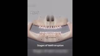 Stages of teeth eruption [upl. by Ramahs]