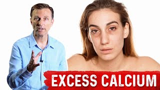 Serious Excess Calcium Side Effects SoftTissue Calcium – DrBerg [upl. by Auqenes]