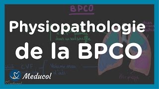 Emphysème pulmonaire et BPCO physiopathologie et causes [upl. by Malcolm]