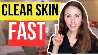 How To Help Your Skin Clear Up Fast [upl. by Ssepmet578]