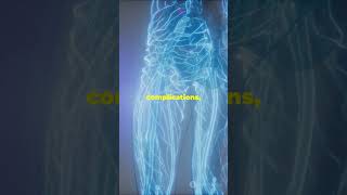 Late Diagnosis of Marfan Syndrome A Sil pencis researcherMarfanSyndrome MedicalAwarenessscience [upl. by Nylsej]