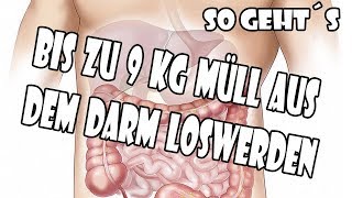 In deinem Darm können sich bis zu 9 Kg Müll ansammeln Mit diesen 3 Mitteln wirst du ihn los [upl. by Sandeep]