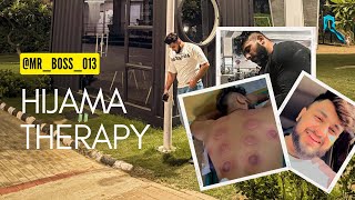 HIJAMA THERAPYMUSCLES RECOVERY💪TRICEP WORKOUT [upl. by Ahsillek]