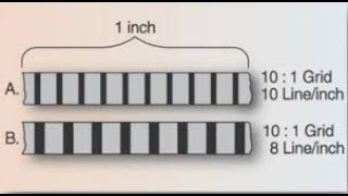 Lecture  Radiographic Grids  Radiographic Physics [upl. by Gavrah]