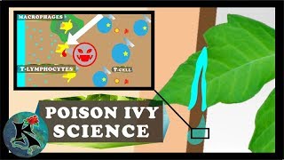 What Poison Ivy Does to Your Skin Basic Science  Koaw Nature [upl. by Ainegul6]