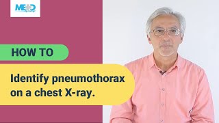 How to identify pneumothorax on a chest Xray [upl. by Cyb]