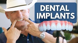 Why No One Tells You The Cost Of Dental Implants [upl. by Zawde]