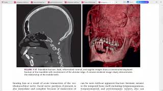 EMERGENCY RADIOLOGY REQUISITES [upl. by Nomael453]