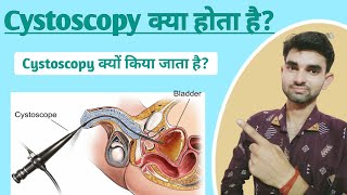 Cystoscopy in Hindi  Cystoscopy meaning  Purpose and Complications of Cystoscopy [upl. by Gibe203]