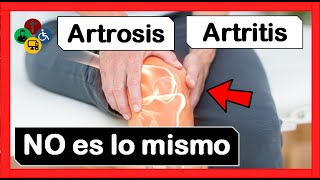 ¿Cuales son las DIFERENCIAS ARTRITIS Y ARTROSIS [upl. by Zerdna]