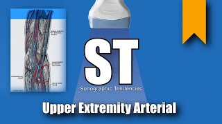 Upper Extremity Arterial Duplex Anatomy and Protocol [upl. by Aindrea]