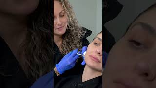 Jawline Contouring with JUVÉDERM VOLUX  Nurse Natalia [upl. by Ramsey]