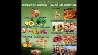 Lupus Journey 4913 Foods that cause and eliminate inflammation [upl. by Nilved559]