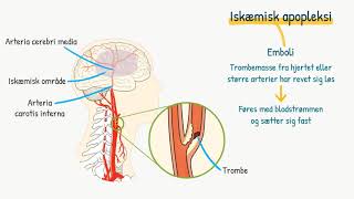 Nervesystemet Apopleksi [upl. by Sidoon]