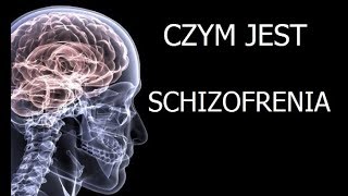 Czym jest schizofrenia [upl. by Akenahc41]