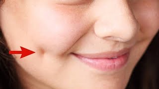 How To Get Dimples Fast And Naturally Beauty Tips [upl. by Siseneg]