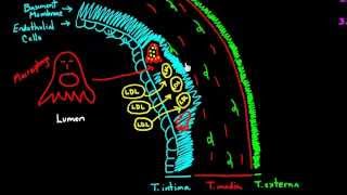 Atherosclerosis  Part 1 [upl. by Ivatts662]