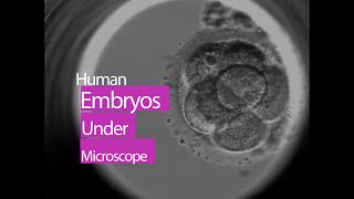 Human Embryo Under Microscope  This is How Life Begins at Conception [upl. by Chenee278]