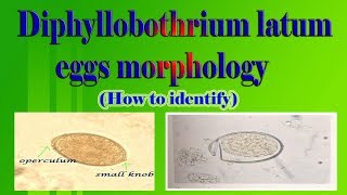 Diphyllobothrium latum eggs morphology How to identify [upl. by Knute]