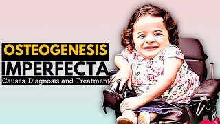 OSTEOGENESIS IMPERFECTA OI Causes Signs and Symptoms Diagnosis and Treatment [upl. by Lohman]