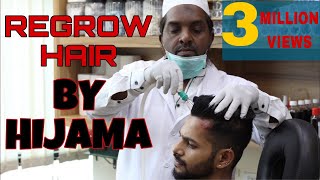 REGROW HAIR BY CUPPING  PART1  HINDI  ANI RAY [upl. by Ecidnak689]